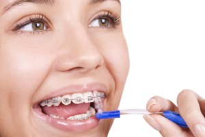 You woman cleaning her dental braces