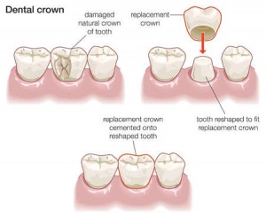 ccrown