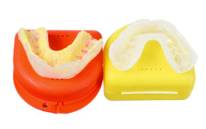 Dental Mouthguard in Case