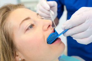 Dentist creating a custom mouthguard